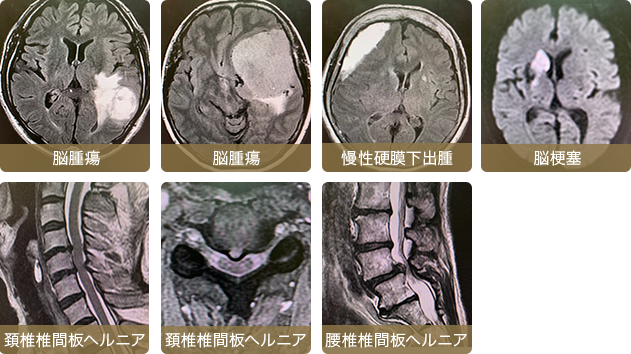 MRI (磁気共鳴画像検査)